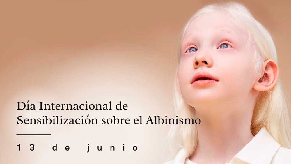 Día Internacional de Sensibilización sobre el Albinismo